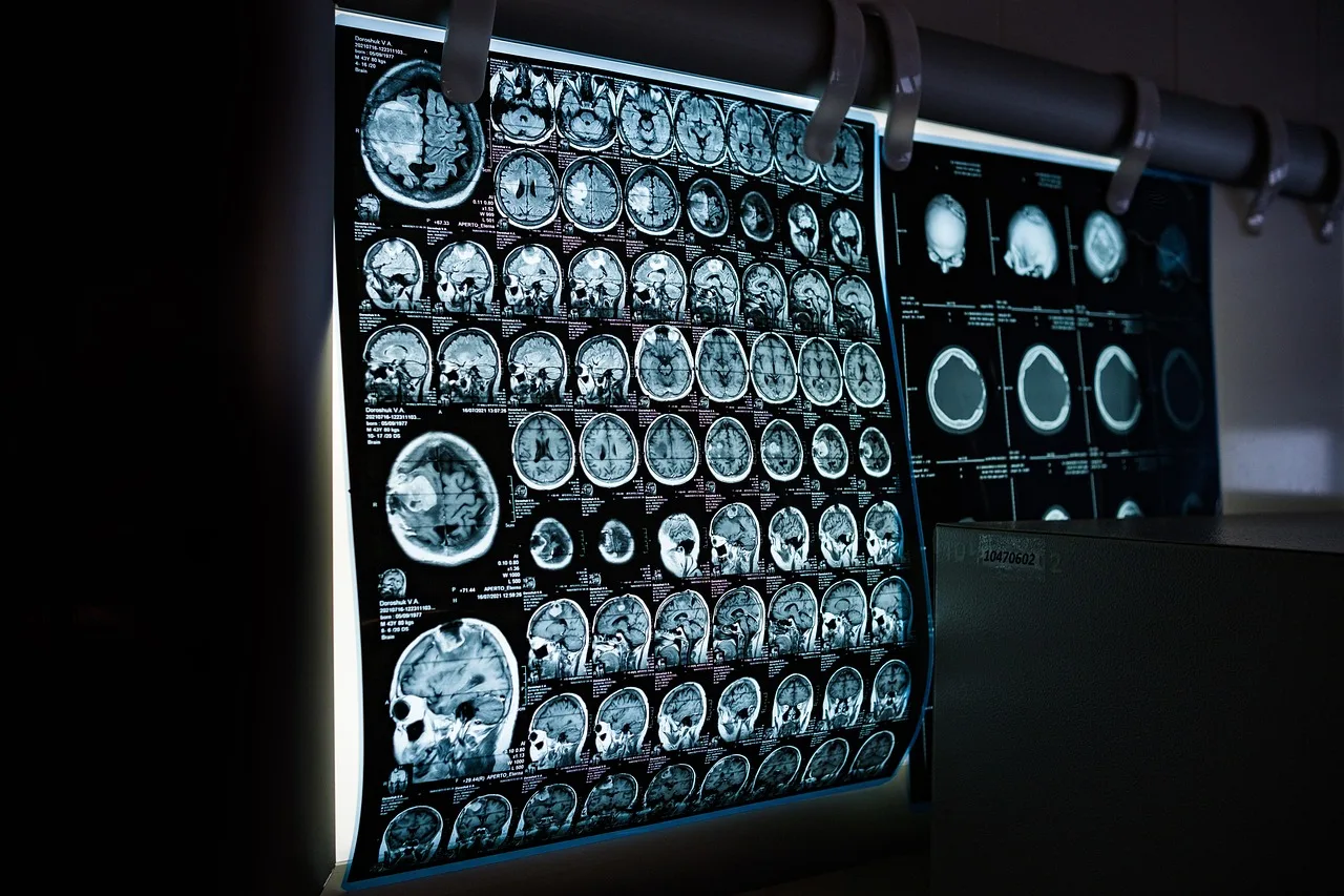 The Neuroscience of Meditation